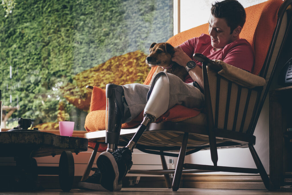 Amputee man enjoying time with his dog on the sofa